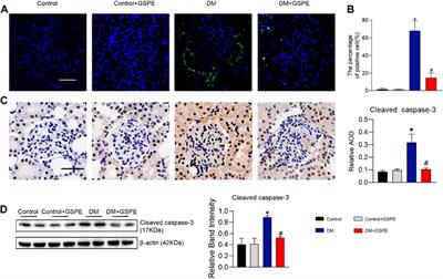 Grape seed proanthocyanidin extract targets p66Shc to regulate mitochondrial biogenesis and dynamics in diabetic kidney disease